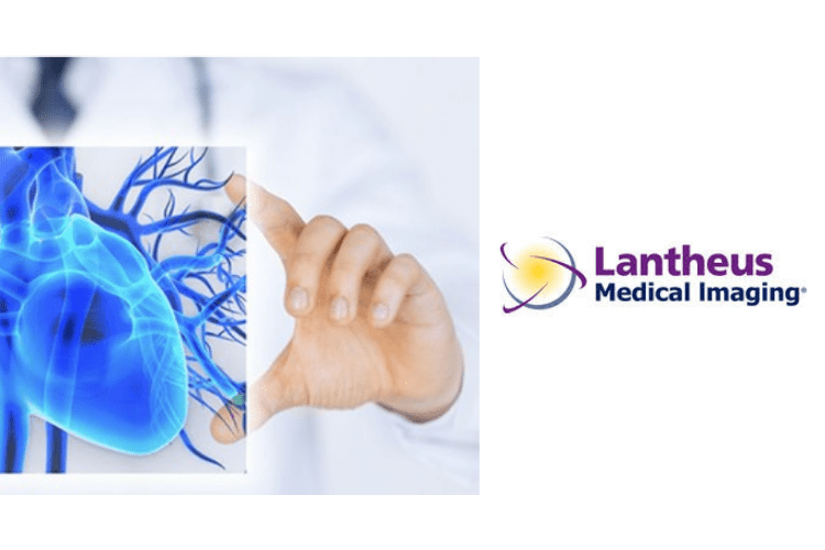 Lantheus medical imaging